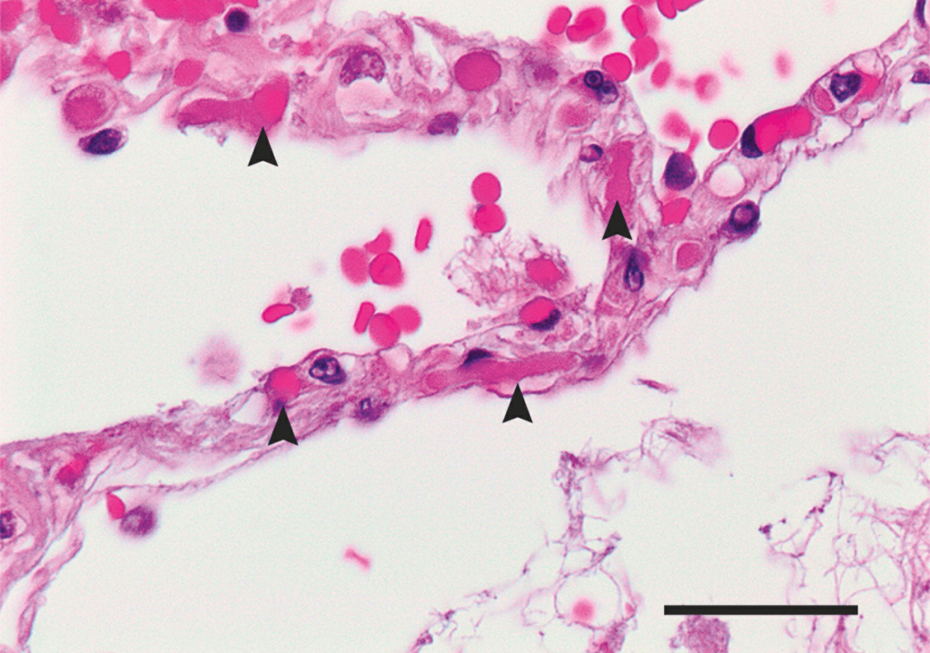 Developing biological hybrid robots for cancer treatment