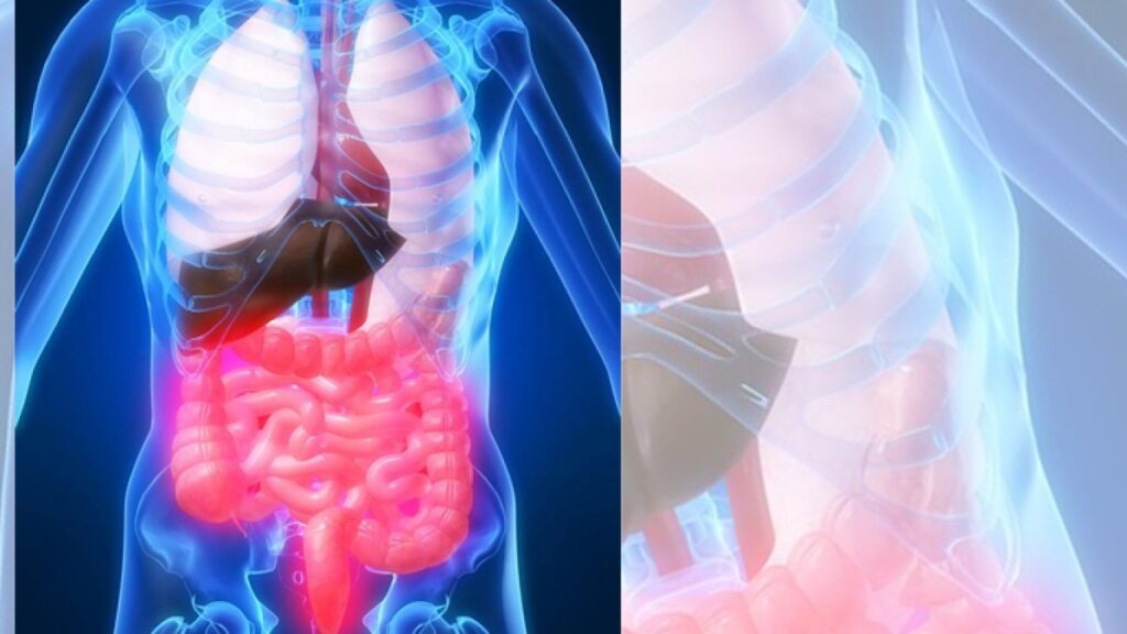 Microscopic robots to treat inflammatory bowel disease