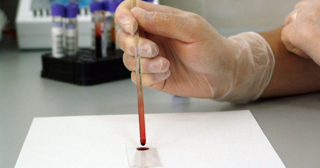 One drop of blood to check for several diseases in a few minutes