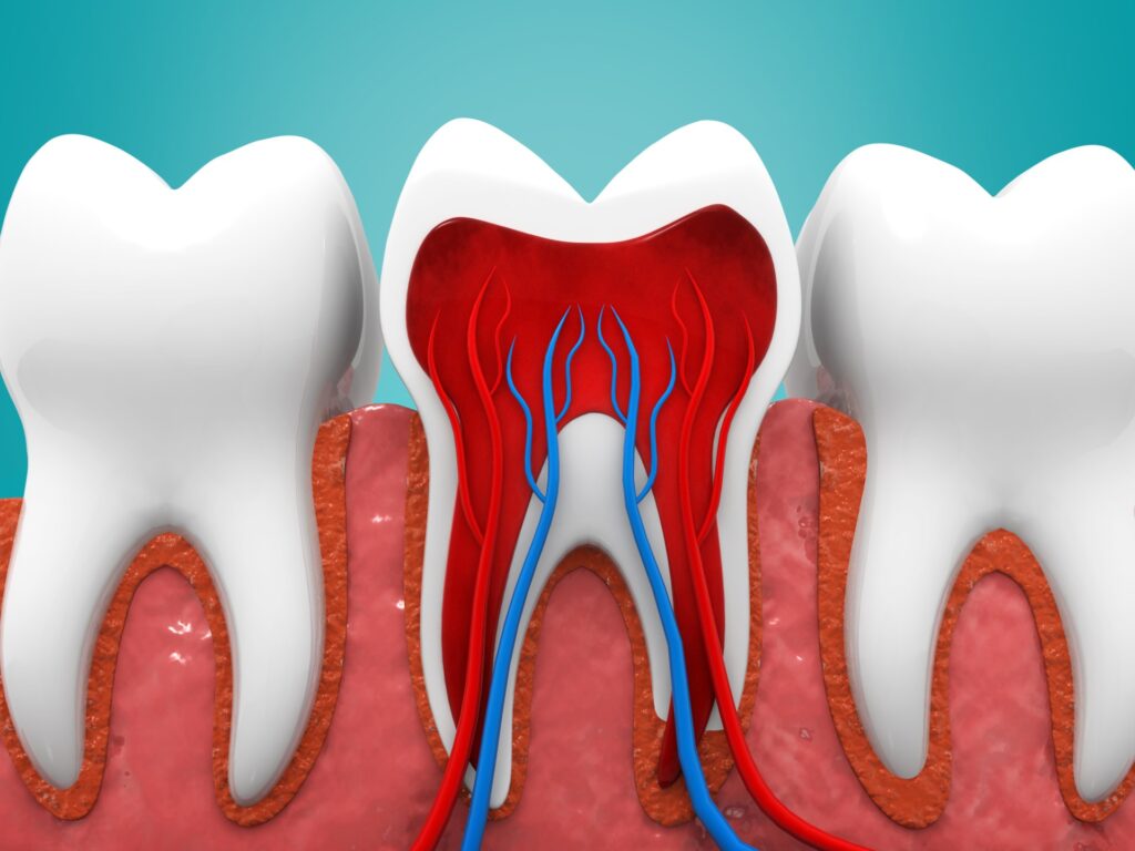 When does a tooth need a root canal treatment?