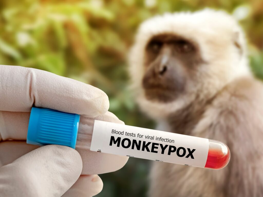 Monkeypox testing ramped up worldwide