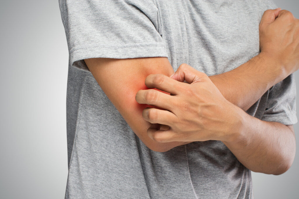Study solves a mystery that has plagued the lives of millions: the cause of chronic itching