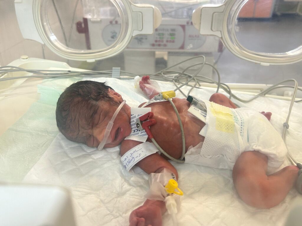 An investigation by Al Jazeera Net reveals an increase in congenital malformations among newborns in Gaza