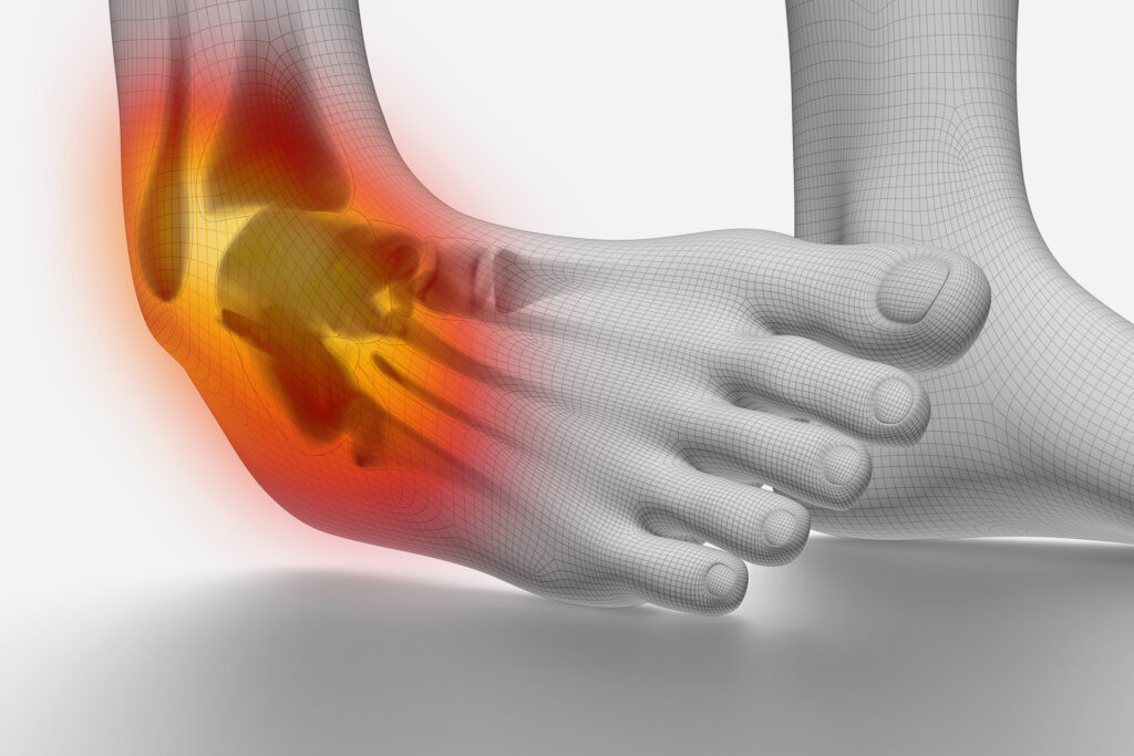 Ankle Injuries: Symptoms and Treatment