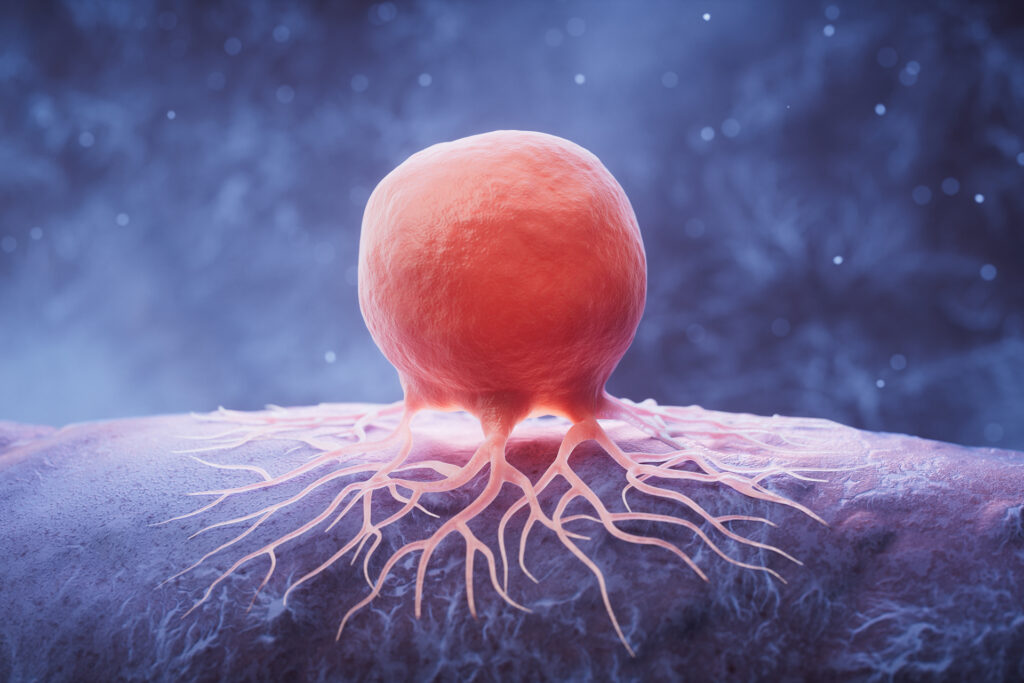Cancer cells use fat to hide from the immune system.