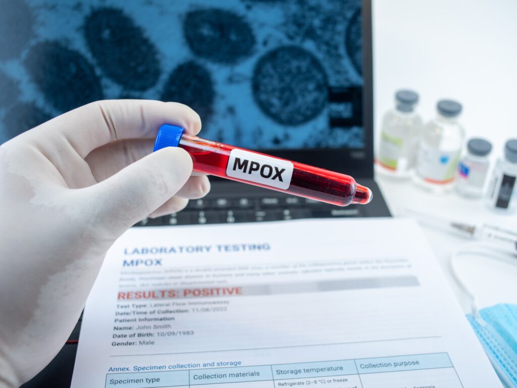 India reports first case of fast-spreading monkeypox