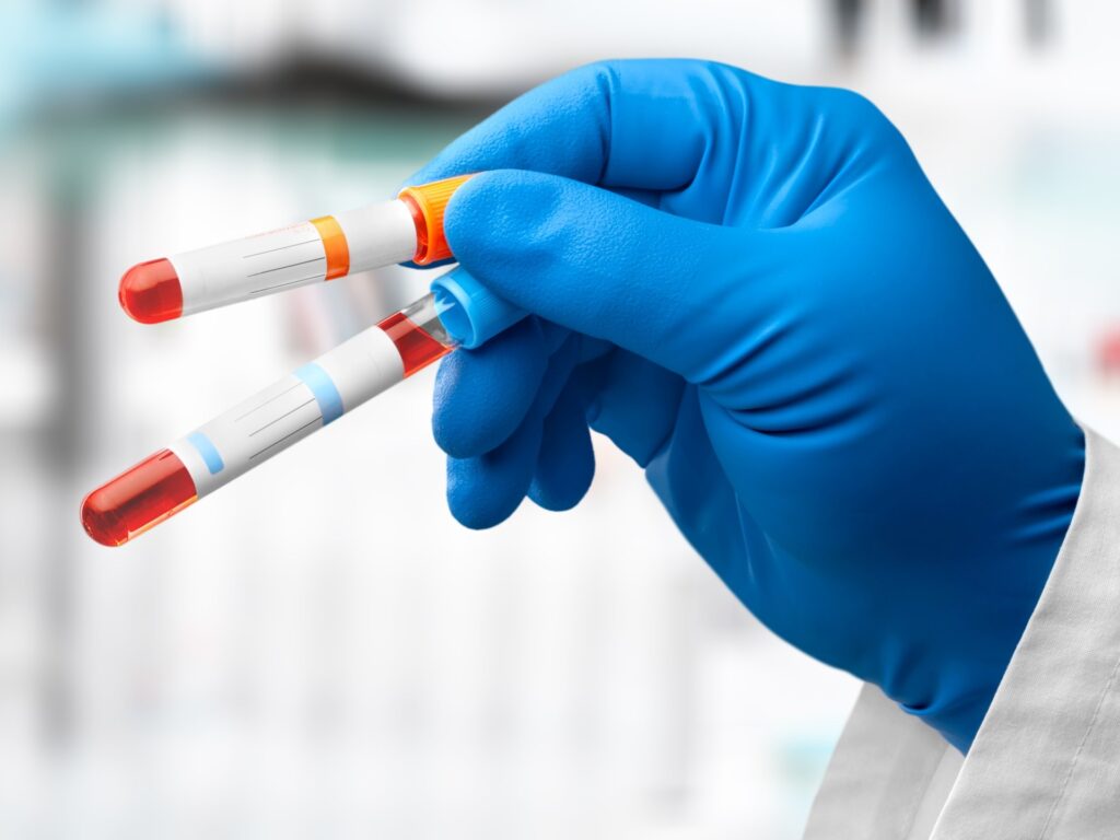 Test predicts heart attacks and strokes in women 30 years before they happen