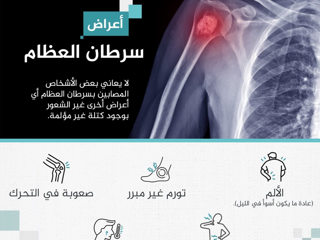 Including bone pain that comes like a stab wound. These are symptoms of bone cancer
