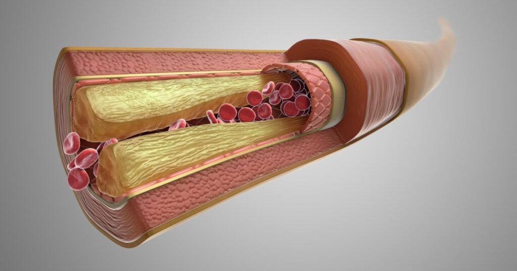 Hypernatremia: Symptoms and causes