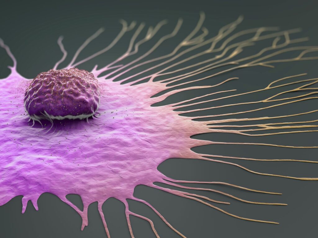 Does air pollution raise rates of head and neck cancer?