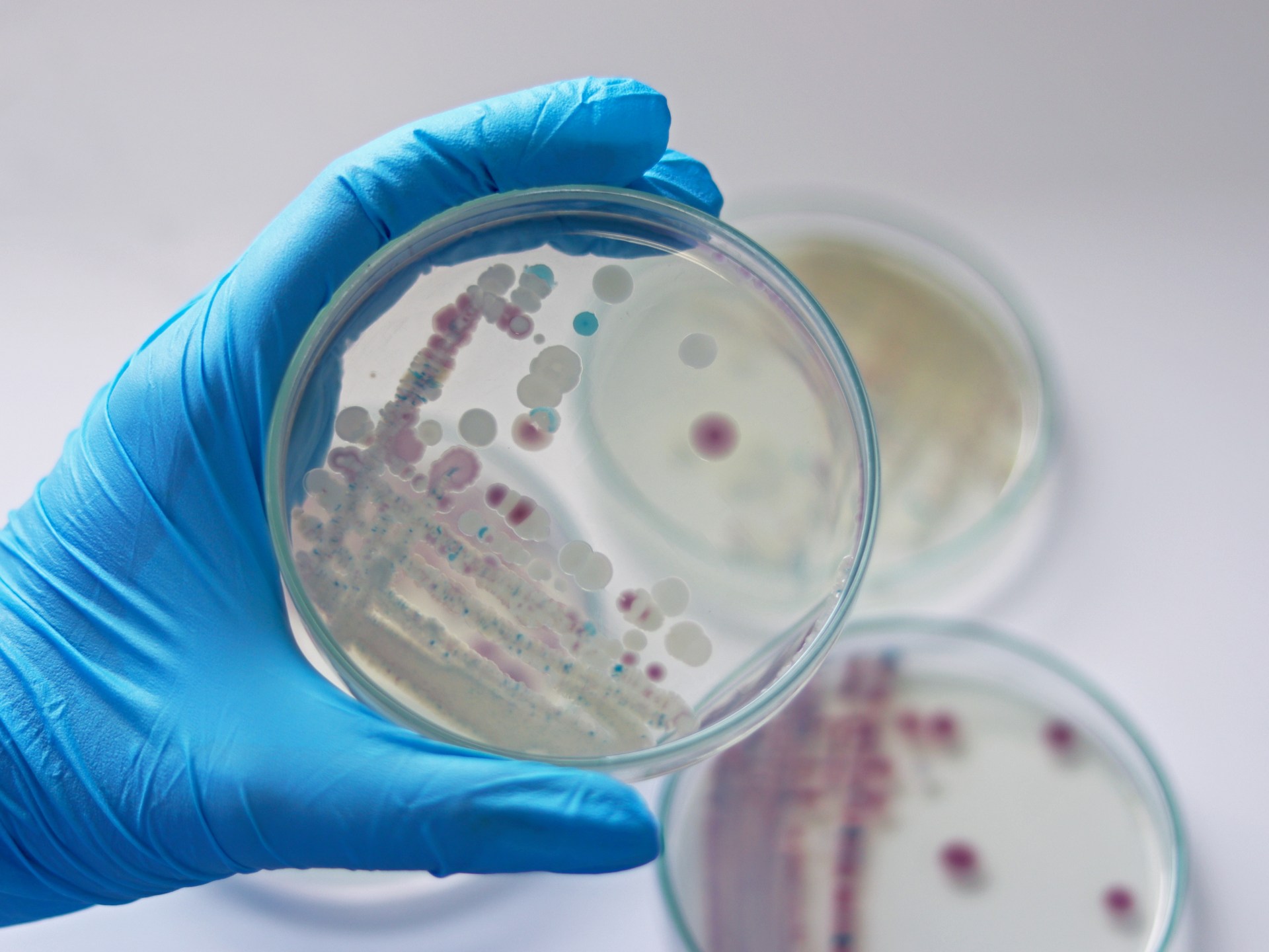 Find a secret weapon against superbugs