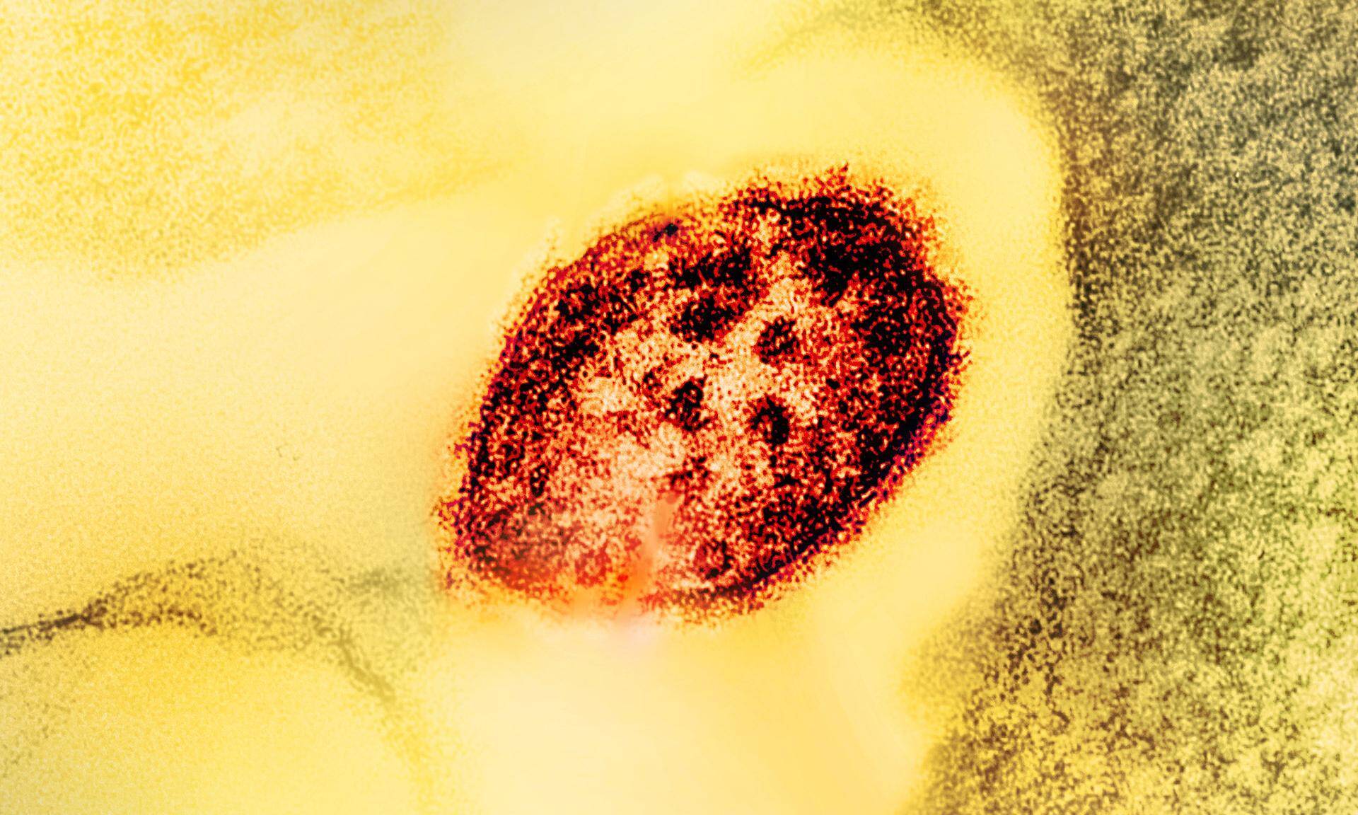 Are we facing a new Corona? A mysterious disease appeared in Congo and killed 143 people