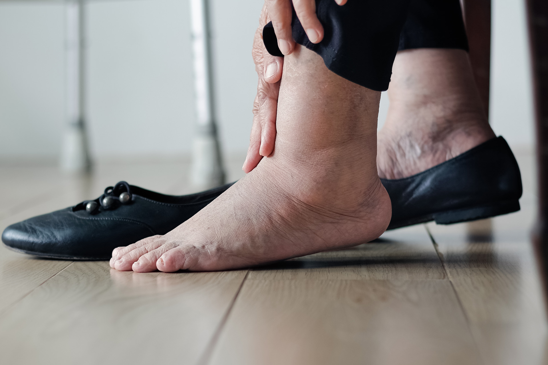 Leg cramps... causes and treatment