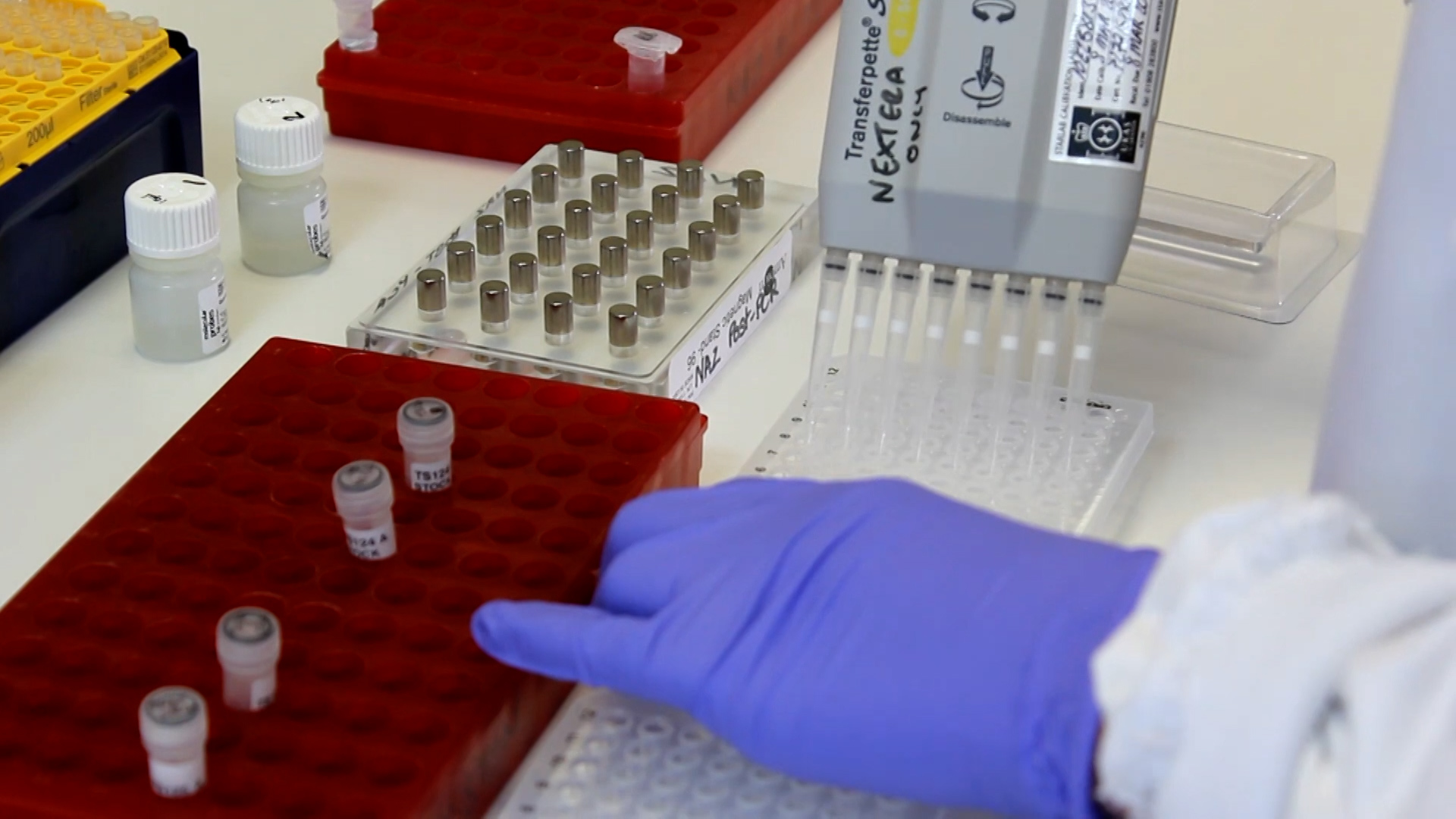 Signs that you have chronic inflammation