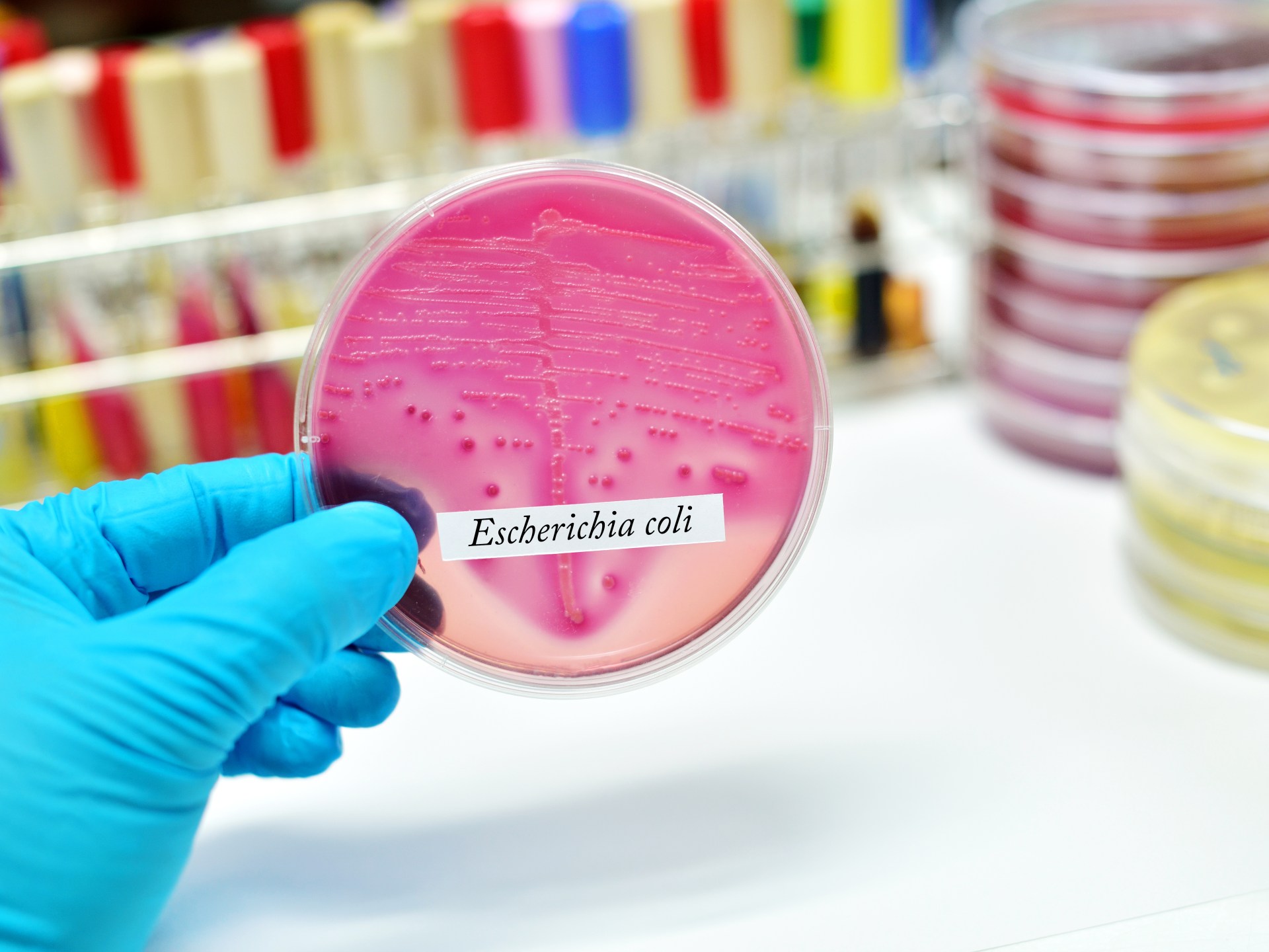 Study: Addressing strains of E. coli bacteria reduces the risk of cancer