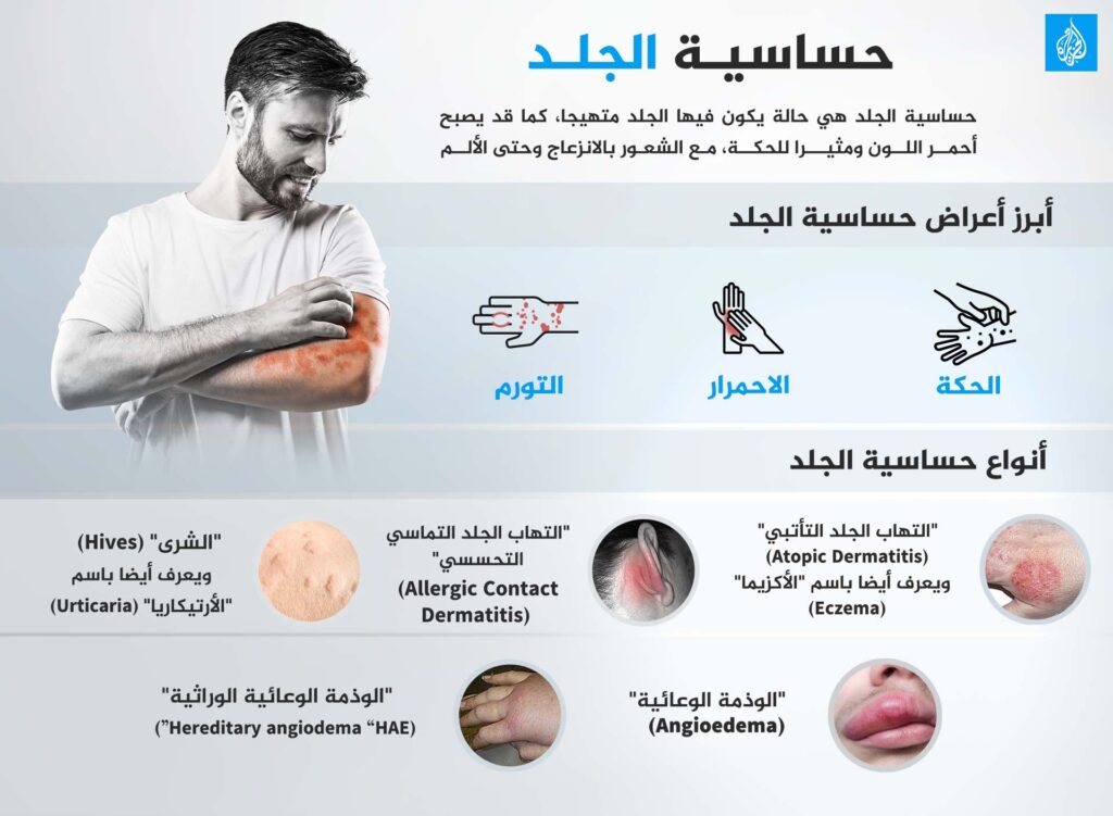 Study: Psychological stress increases skin sensitivity