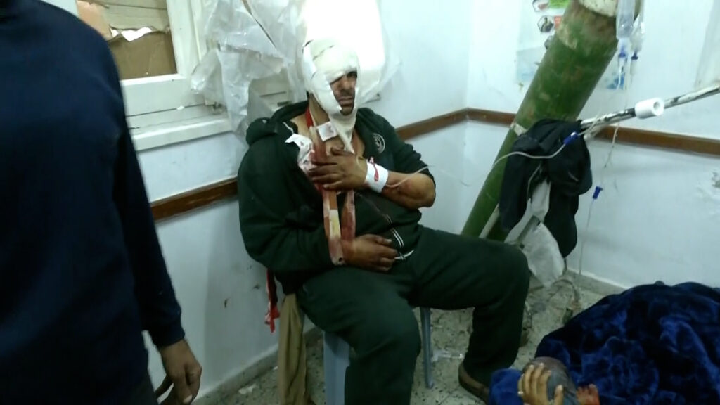 A health official in Gaza: We have recorded 4,500 cases of amputation since the beginning of the Israeli genocide