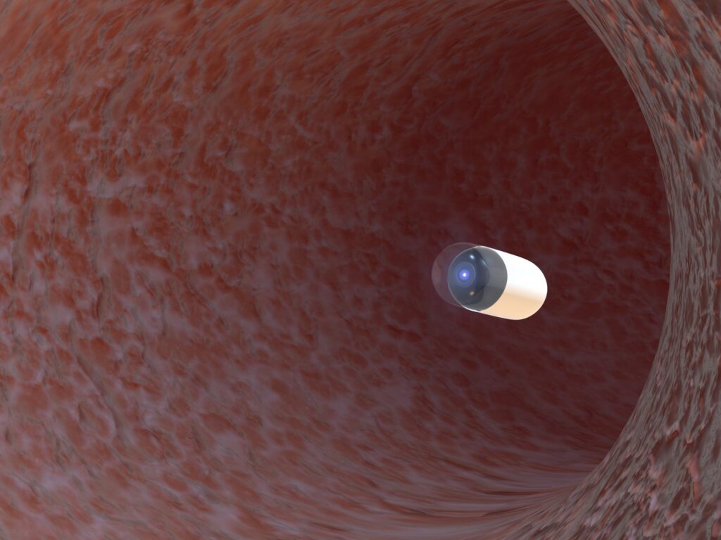Scientists send a capsule into the digestive system, so what do they find?