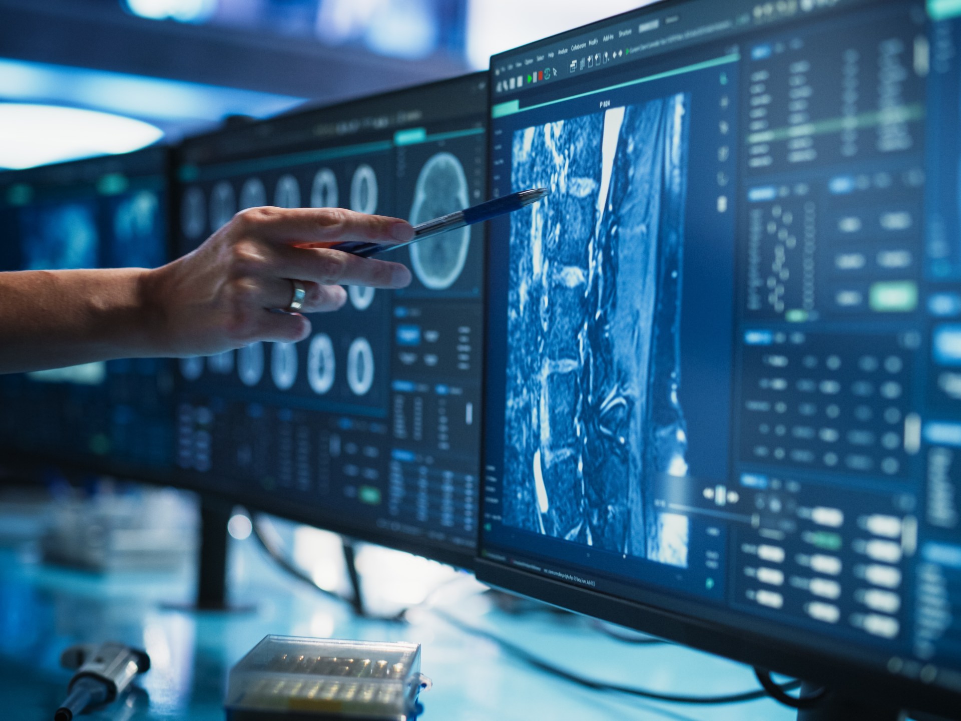 A study reveals that the shape of aggressive breast tumors is similar to the fruit of chestnut