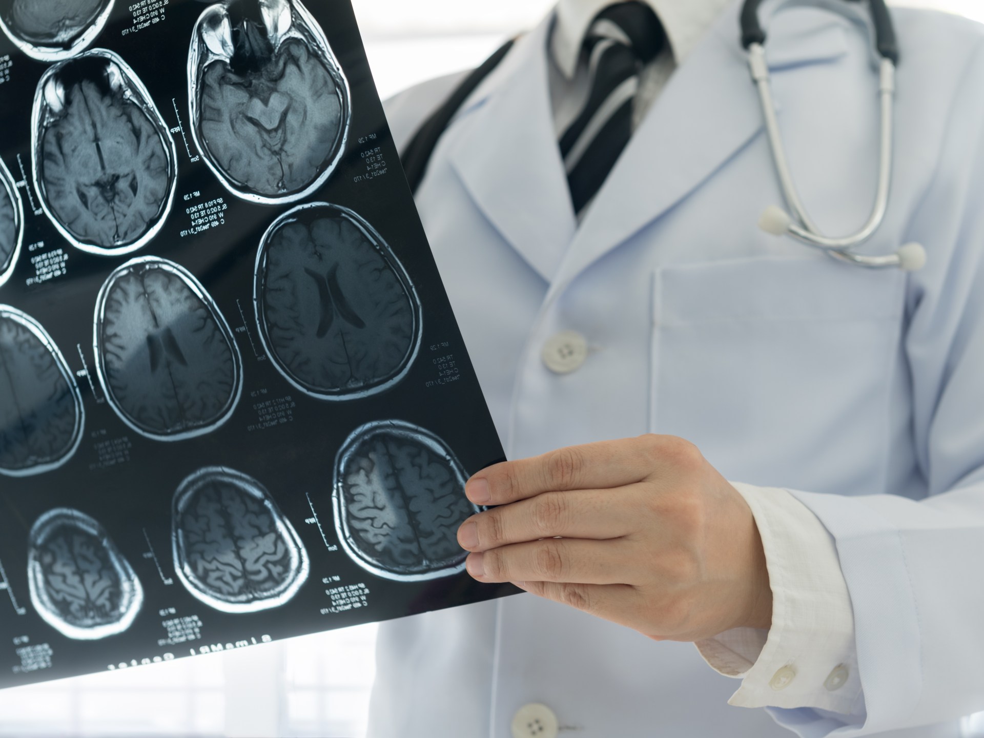 How many hours does this drug give you to save a patient with stroke?