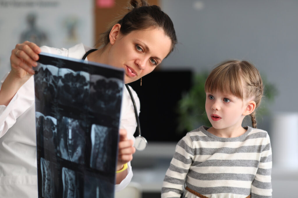 Not just pain .. A study that reveals the early symptoms of bone cancer in children