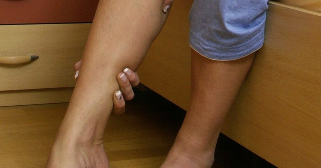 Simple changes in your feet may reflect your heart disease