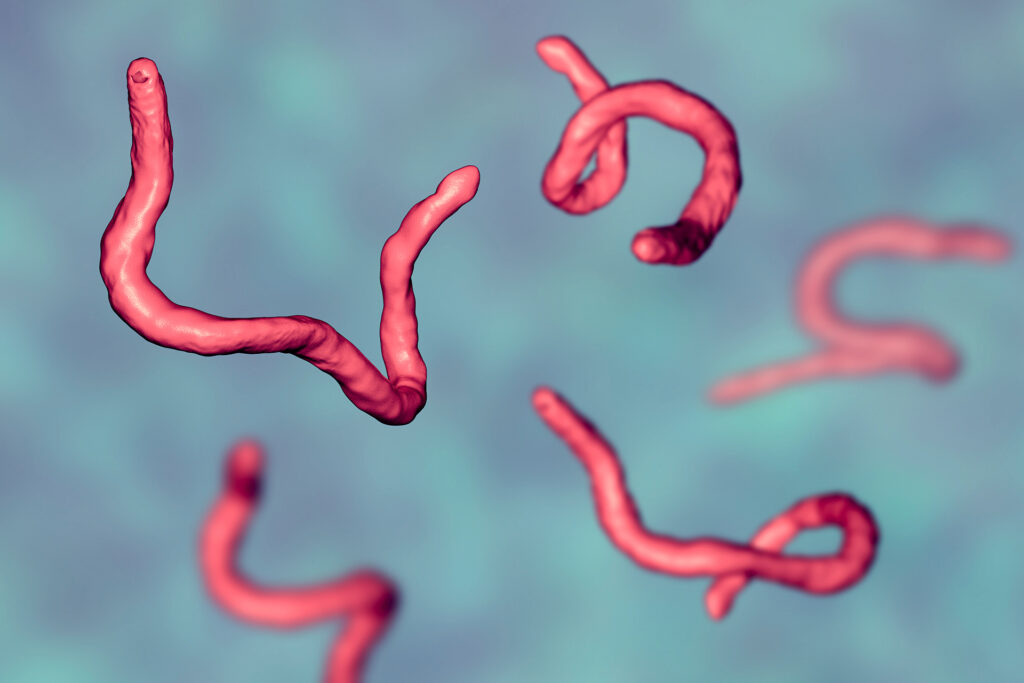 Abdominal pain may reveal the presence of a parasite in your body