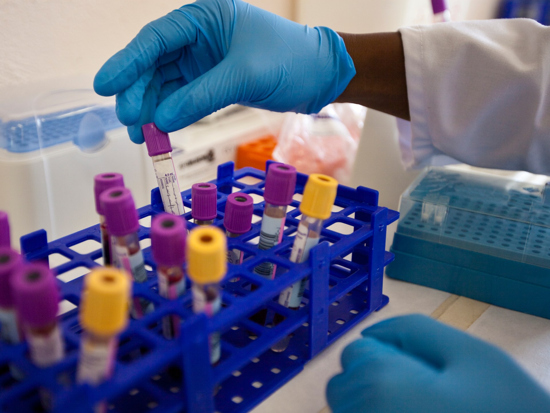 Freezing American aid threatens to fight AIDS in Africa