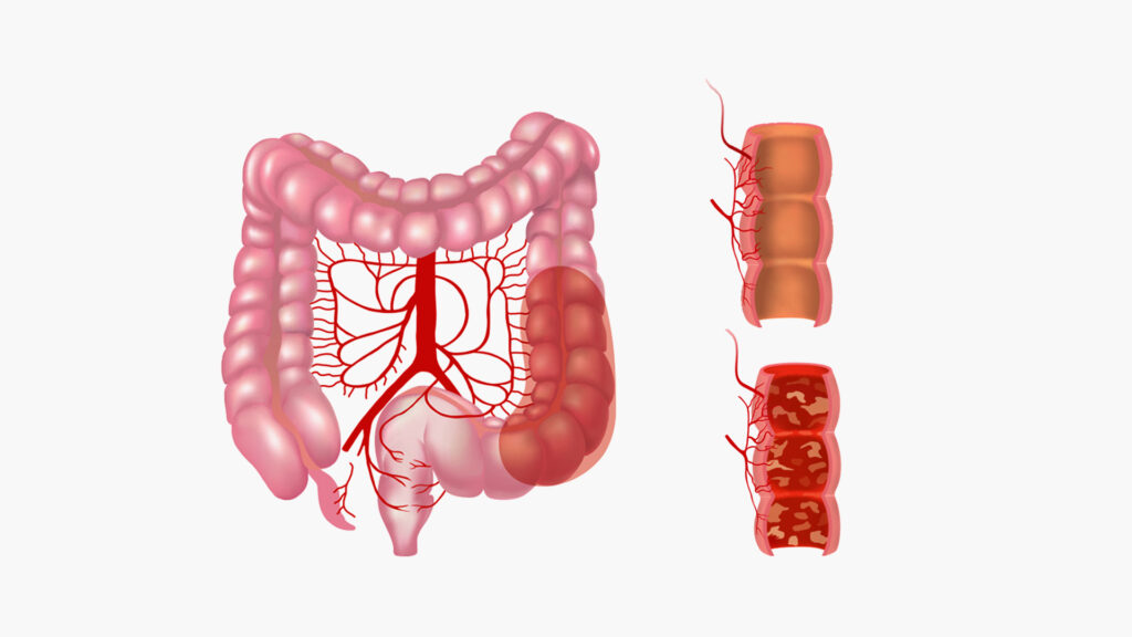 Increasing the diseases of the digestive system in youth are a phenomenon whose causes are still unclear
