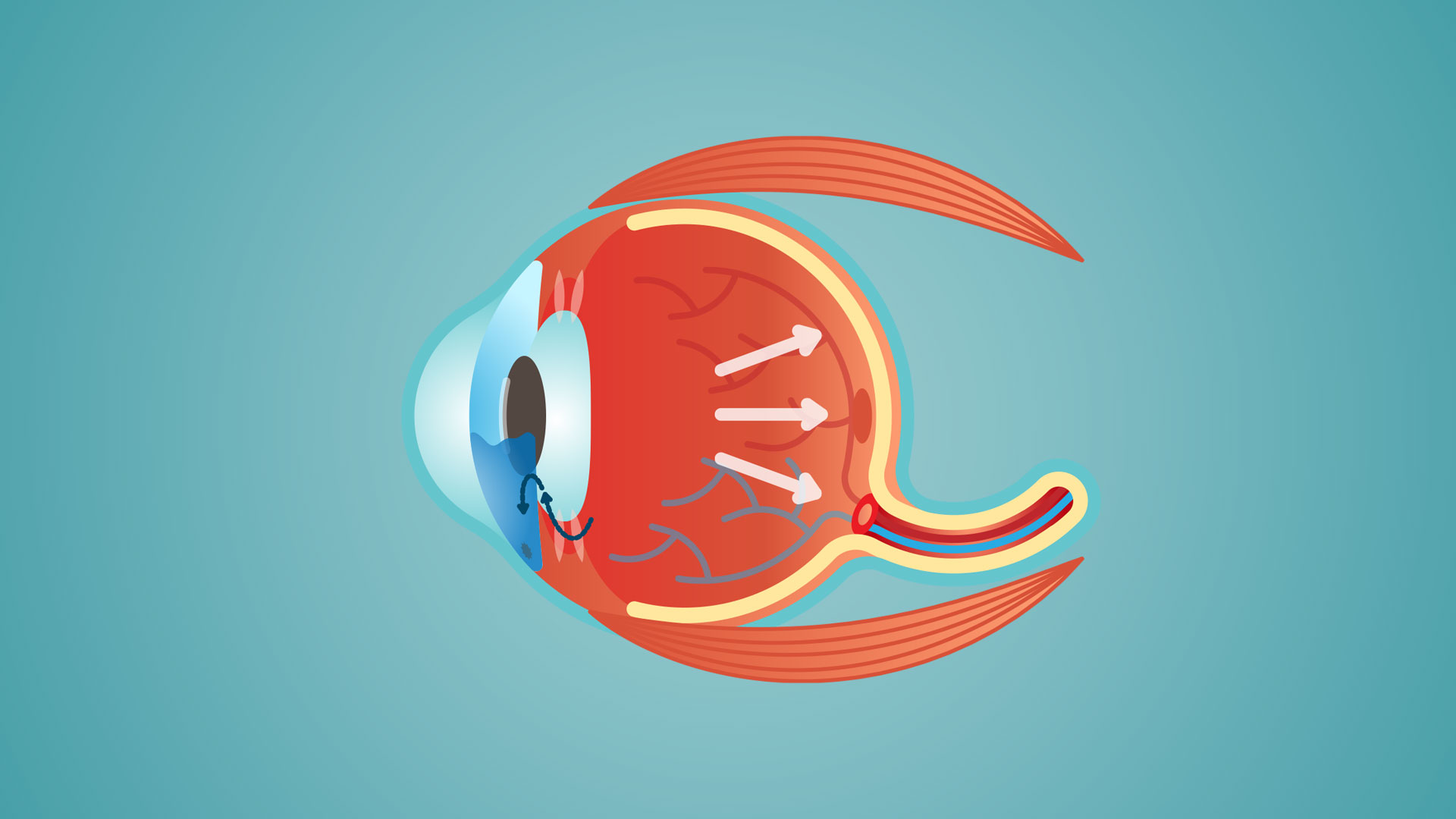 The world celebrates the global week of glucoma