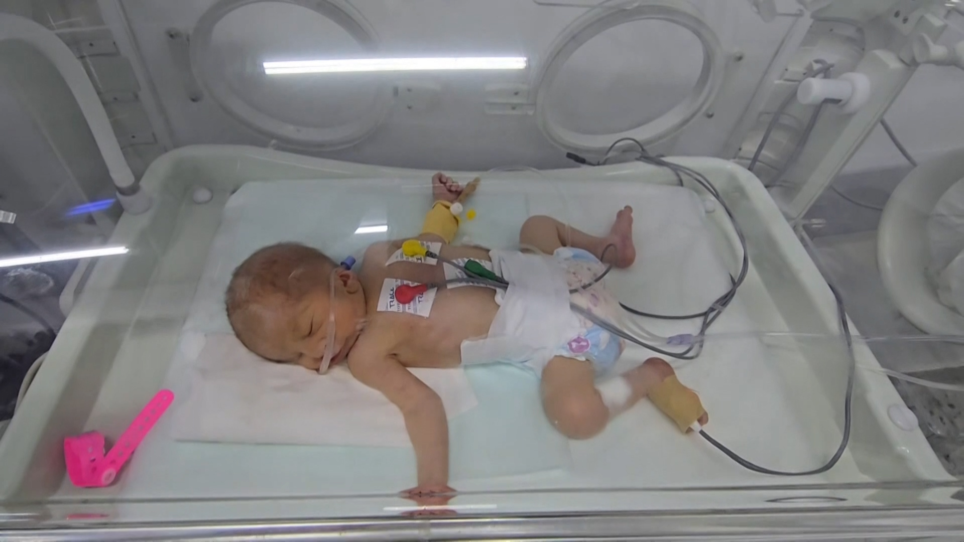 UN report: Israel has partly destroyed the reproductive capacity of the Palestinians in Gaza