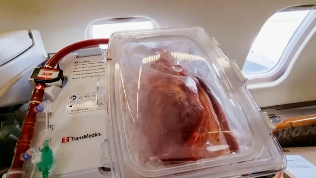 Will the cultivation of organs of genetically modified pigs be a solution to the problem of deficiency?