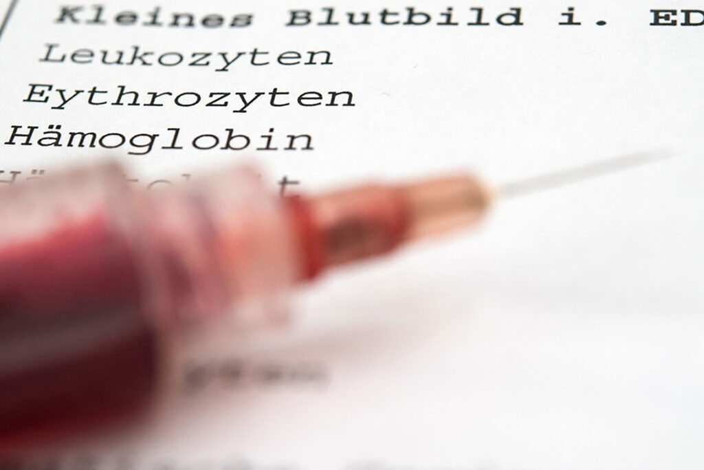 A promising vital indication of early sepsis