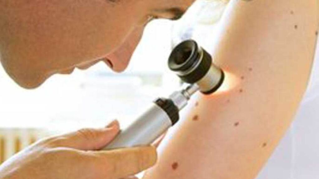 An opportunity for cancer patients in England to get a vaccine quickly