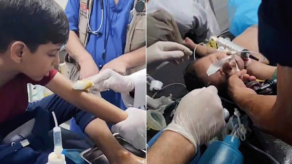 Gaza Health: Israel prevents the entry of polio vaccination threatens 602 thousand children