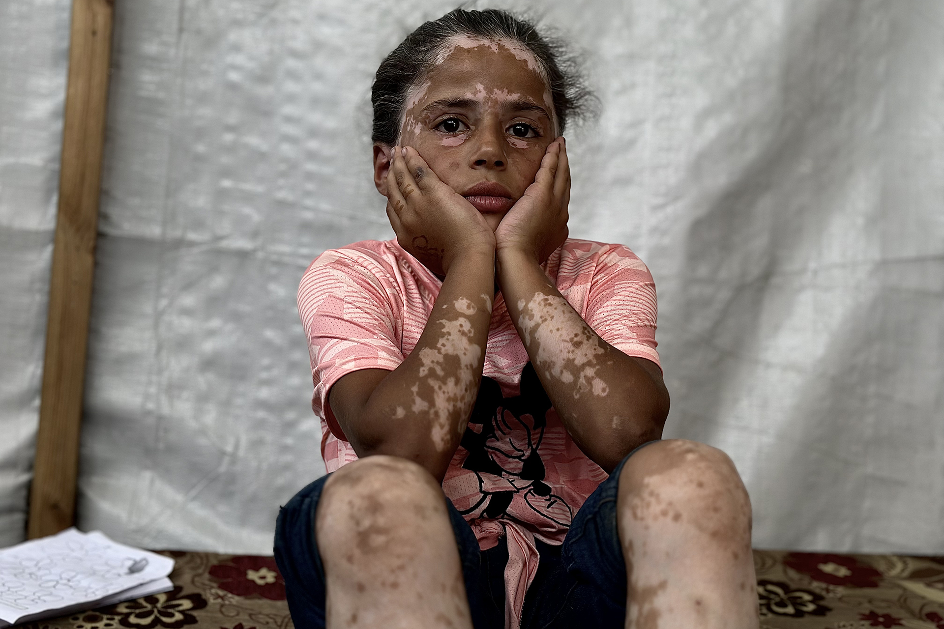 Lana .. a Palestinian girl with an Israeli genocide