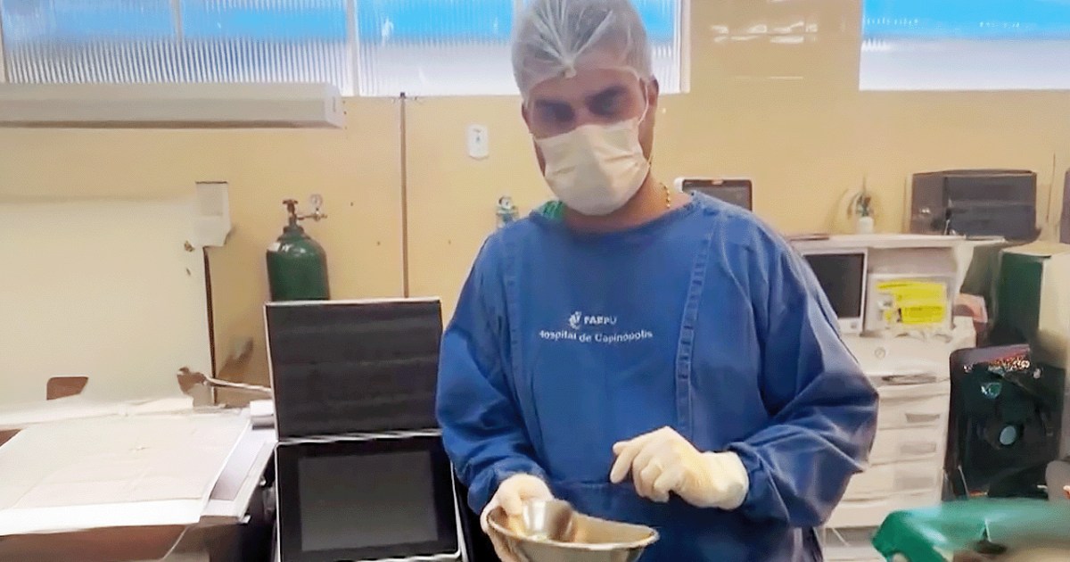 30 stones in a Brazilian kidneys caused by soft drinks ... and amazement on the platforms