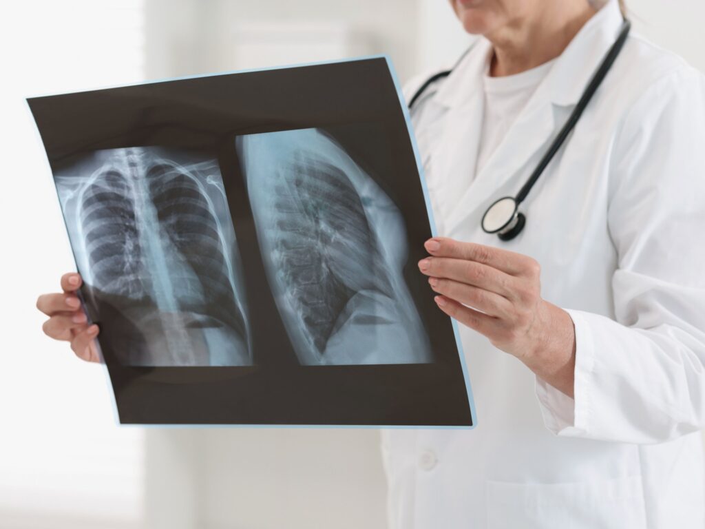 A new algorithm for faster diagnosis of lung cancer