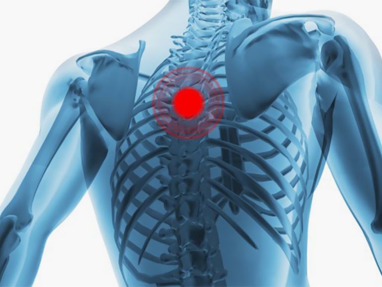 Frace upper back pain