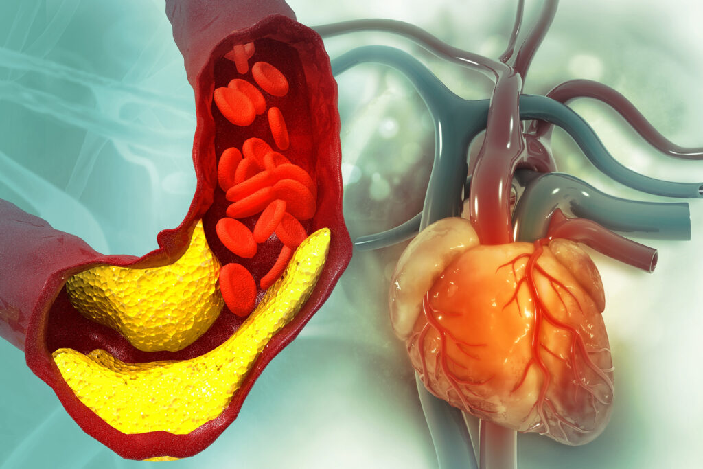 Promising results for a new drug to lower cholesterol