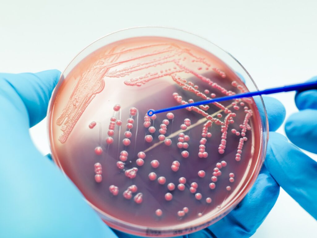 Russian scientists create a murderous material for bacteria