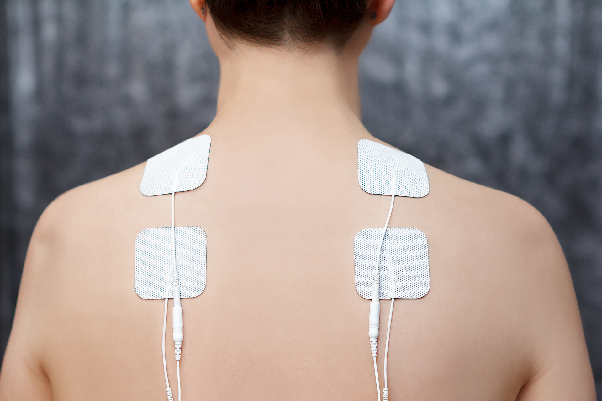 Scientists develop electric poles that open up horizons for the treatment of pain, spasm and paralysis