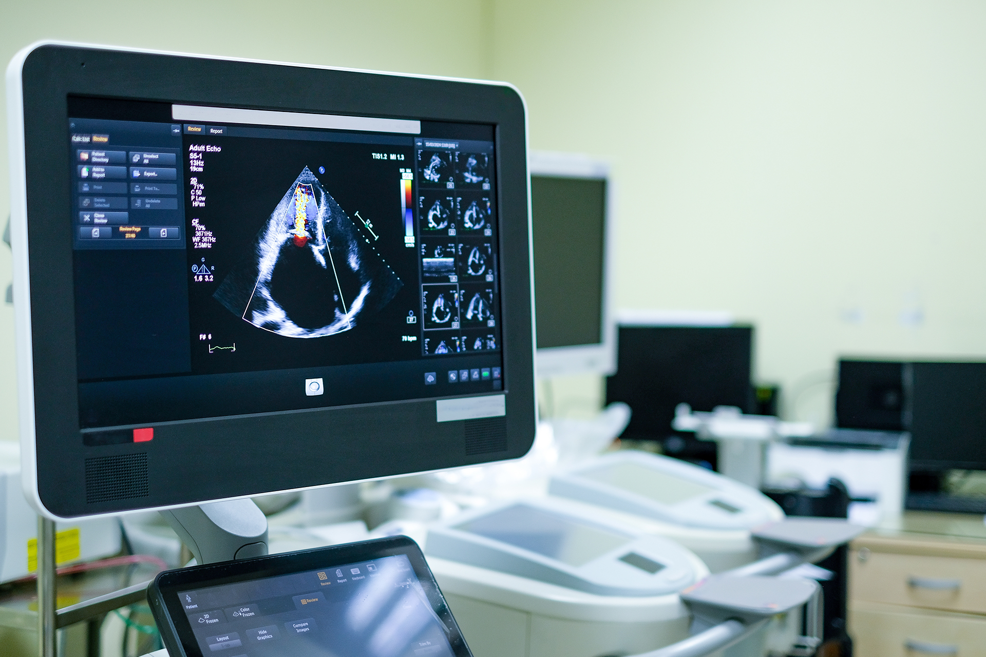 Ultrasound provides 3D printing experiments for medical connectors