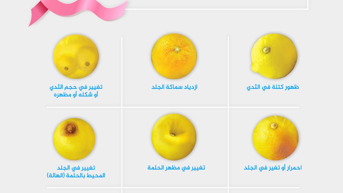 Artificial Intelligence helps determine the extent of breast cancer patient