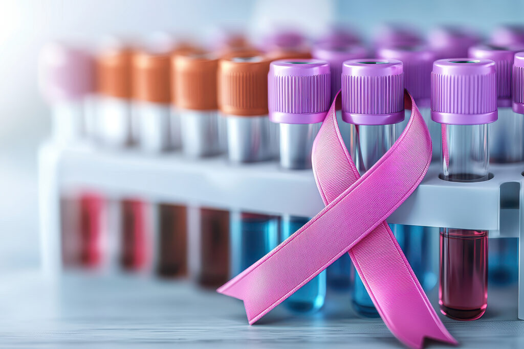A simple blood test reveals the beginning of a setback in breast cancer