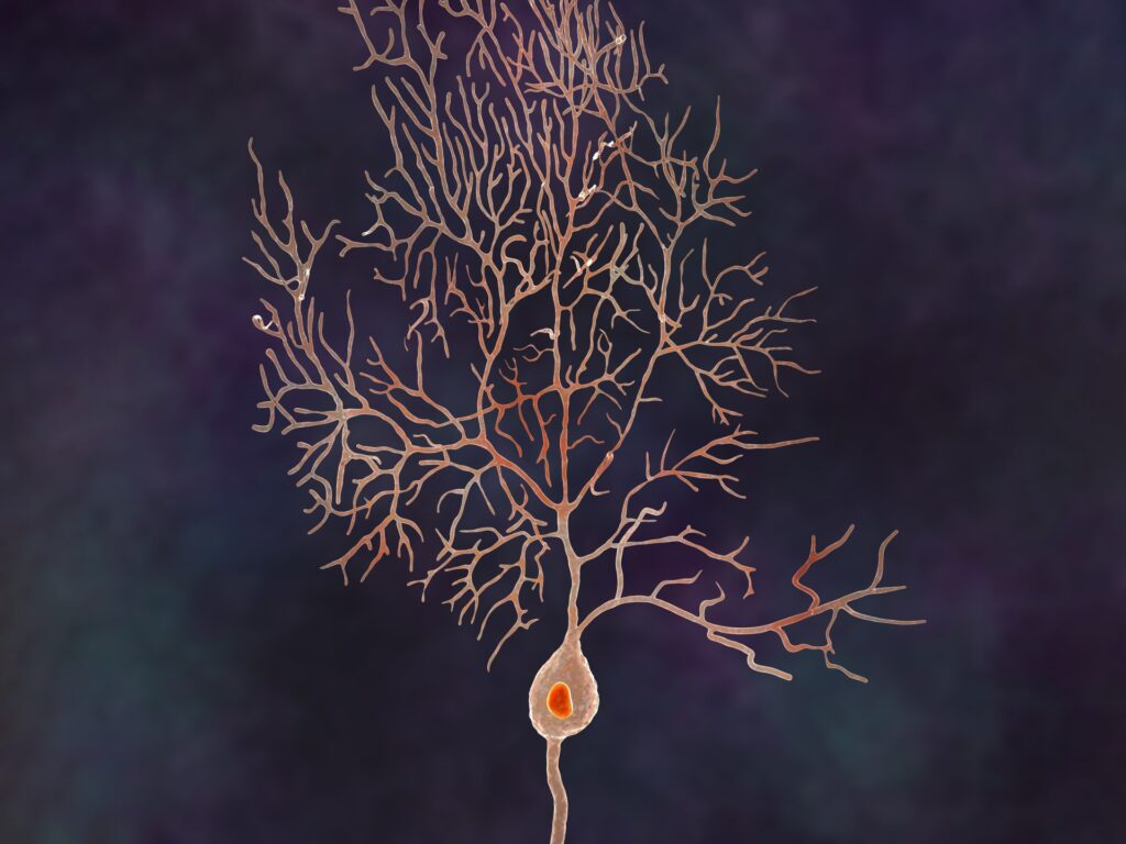 A study preaches the development of new treatments for multiple sclerosis