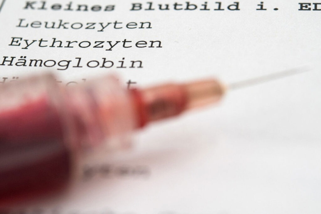 High blood density may threaten your life