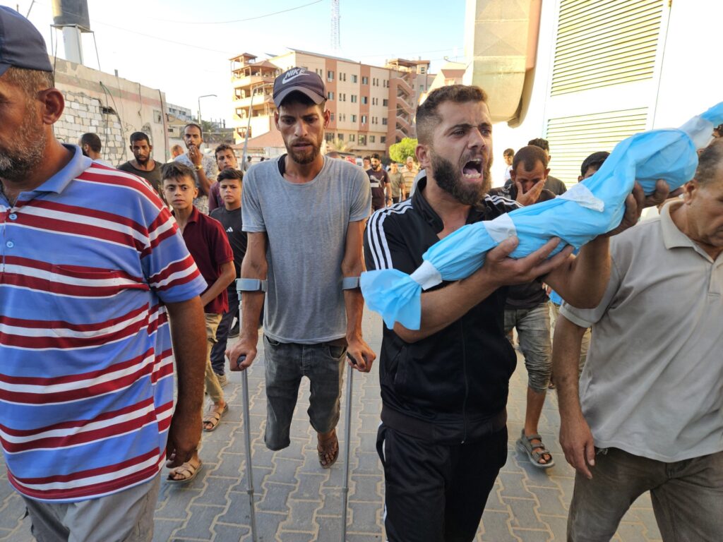 In pictures .. Gaza residents die hunger