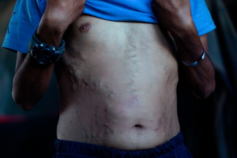 Humanitarian stories .. Umm Muhammad Abu Odeh