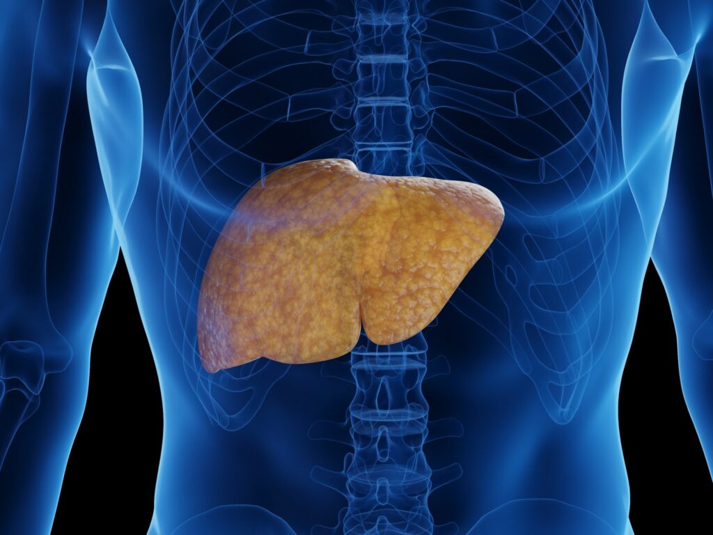 Oily liver disease .. What is it and how is it treated?